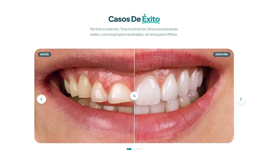 Sección 'Casos De Éxito' con comparador de fotos antes y después del sitio de Dentia